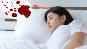 Những giấc mơ thấy máu thường mang nhiều ý nghĩa